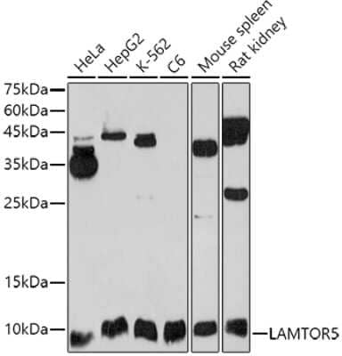 Western Blot: HBXIP Antibody [NBP3-03300] - Western blot analysis of extracts of various cell lines, using (NBP3-03300) at 1:1000 dilution. Secondary antibody: HRP Goat Anti-Rabbit IgG (H+L) at 1:10000 dilution. Lysates/proteins: 25ug per lane. Blocking buffer: 3% nonfat dry milk in TBST. Detection: ECL Basic Kit. Exposure time: 90s.